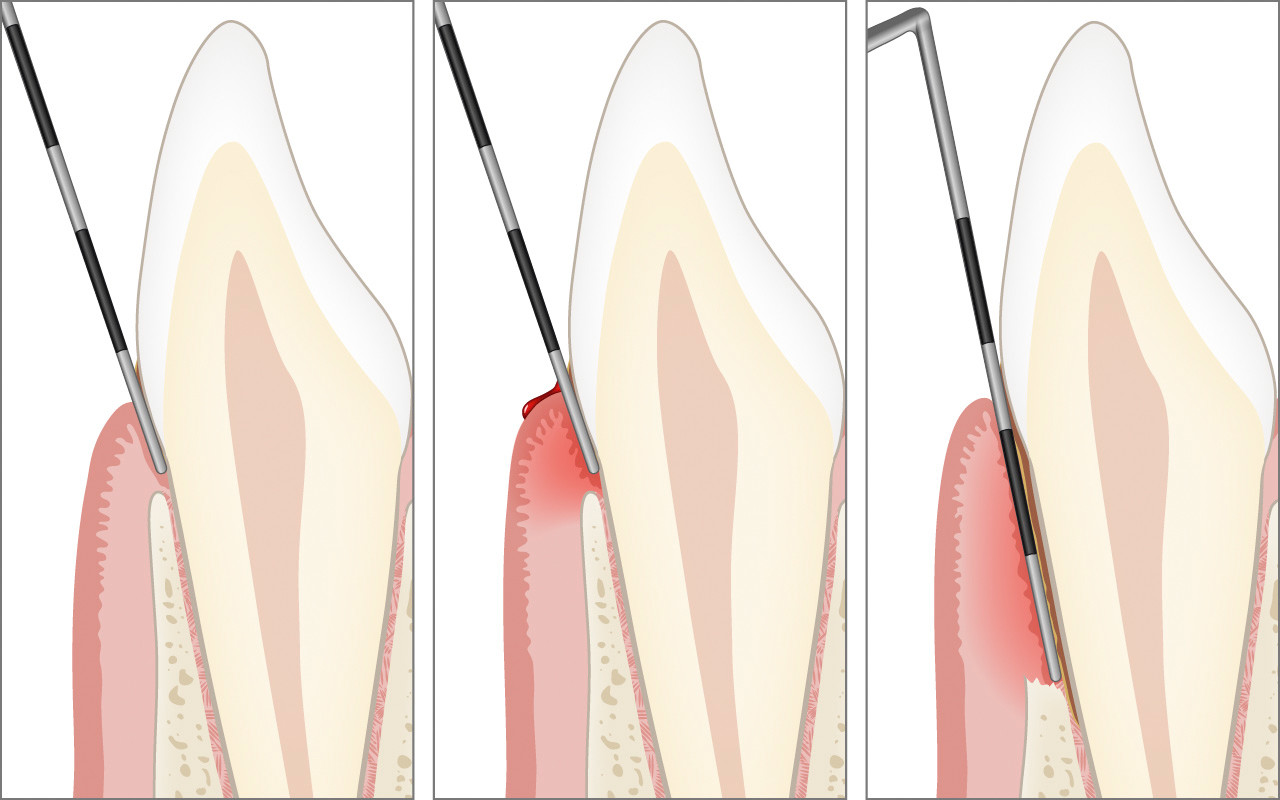 Klinische Untersuchung
