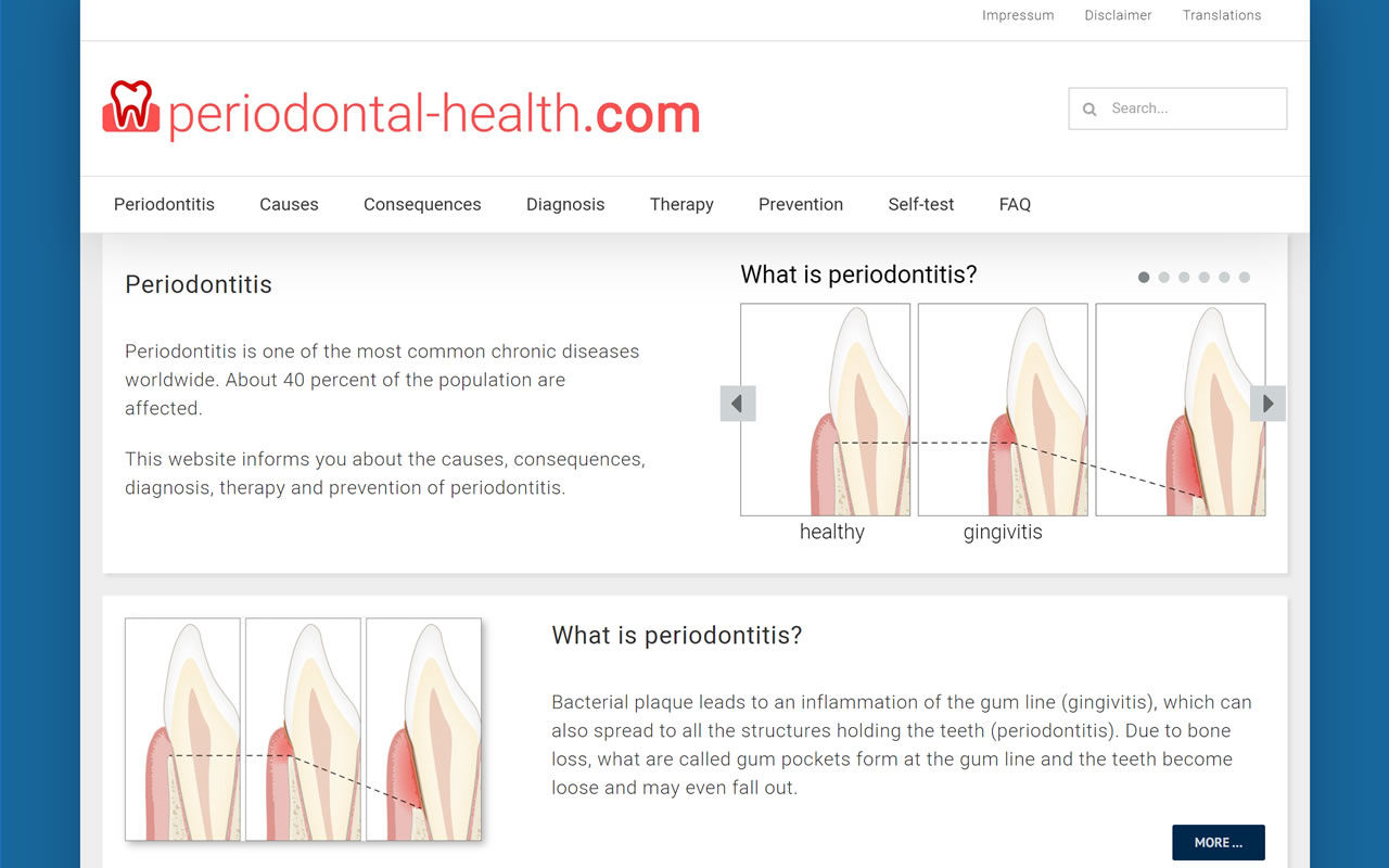 Informationen zur Parodontitis