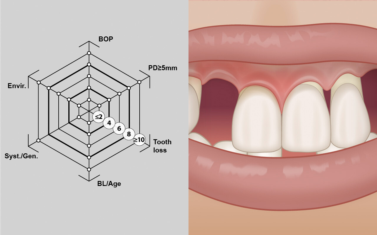 Anzahl der verlorenen Zähne